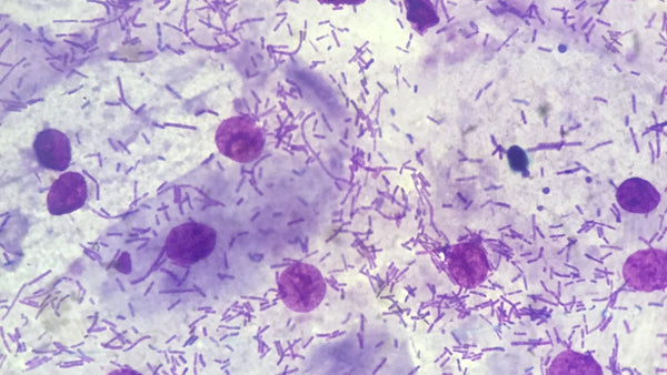 Flora vaginal